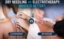 Dry Needling vs Electrotherapy: Which Is Better?